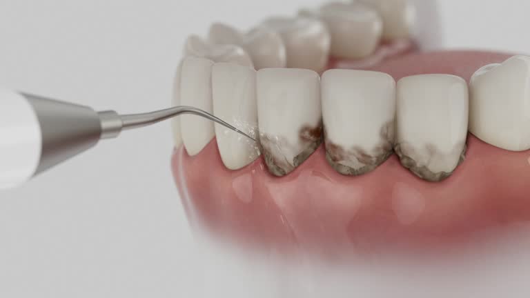 Reliable Dental contractor in Bolindale, OH by Smile Center Dentistry